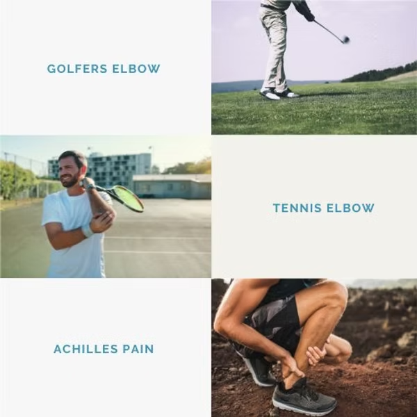Common areas associated with shockwave therapy, including golfer's elbow, tennis elbow, and Achilles pain
